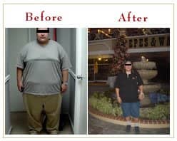 Slider image (7) Panama Gastric Surgery Center